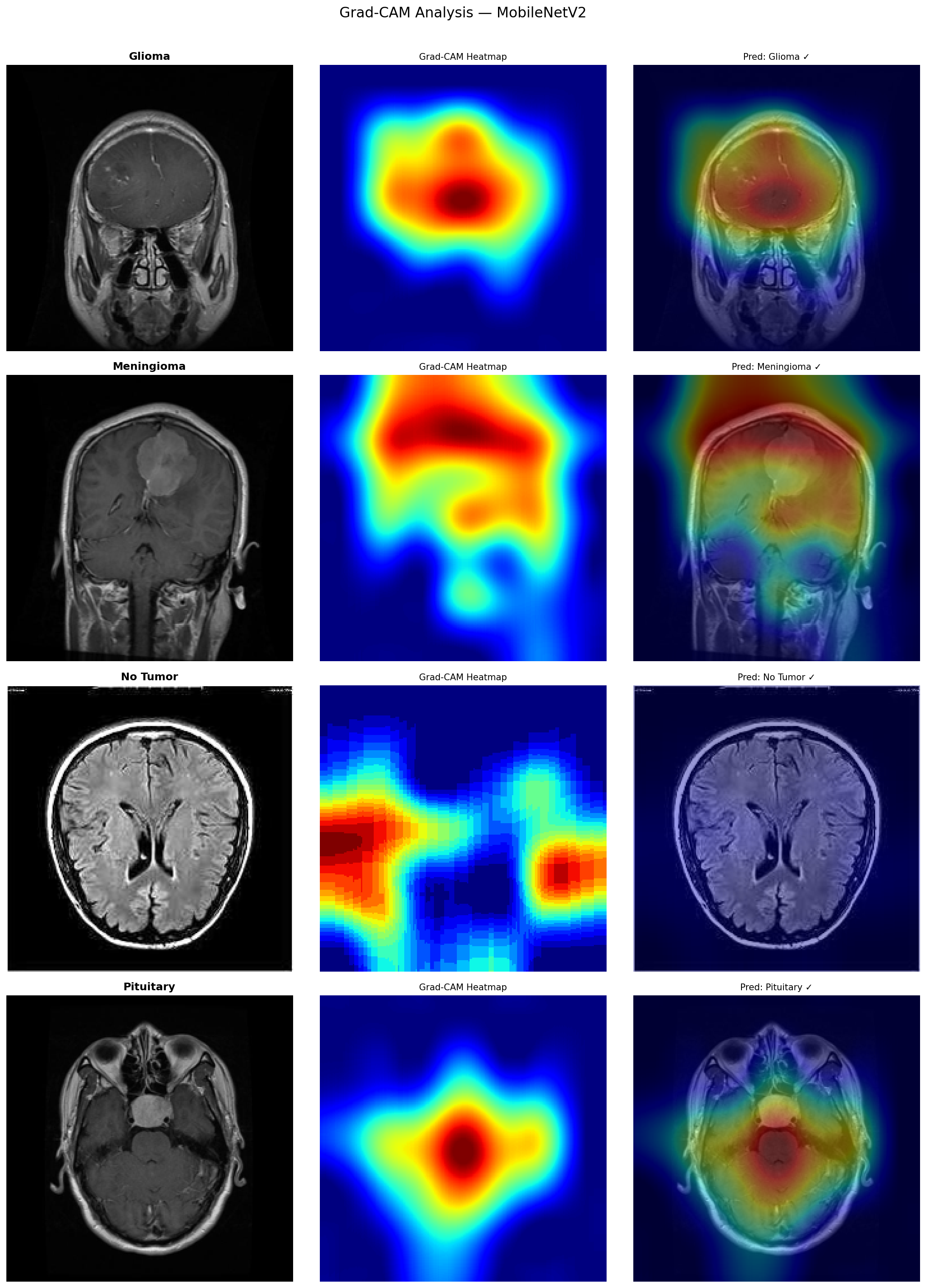 A Window Into the Black Box