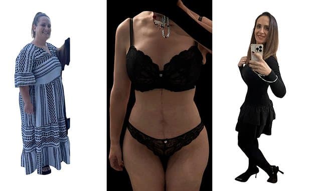 How to get rid of unsightly saggy skin after extreme weight loss: I lost 8.5 stone - but the 'stomach apron' left behind hit my confidence just as much as the weight had. Here's how to banish it