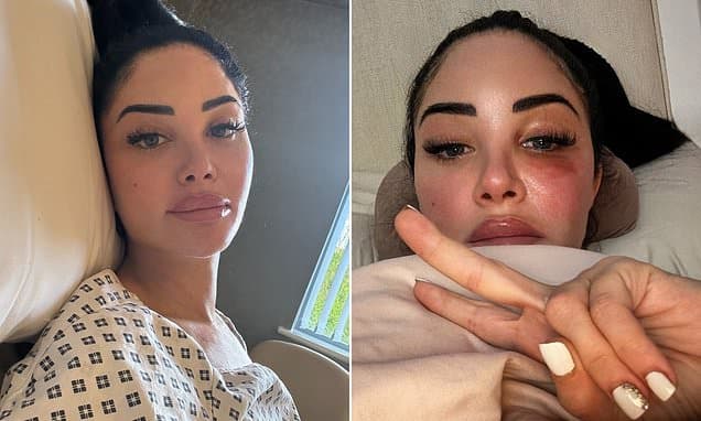 Tulisa suffers a Bell's palsy attack and minor short term paralysis as she cancels egg retrieval after 'crazy life experiences' in candid health update
