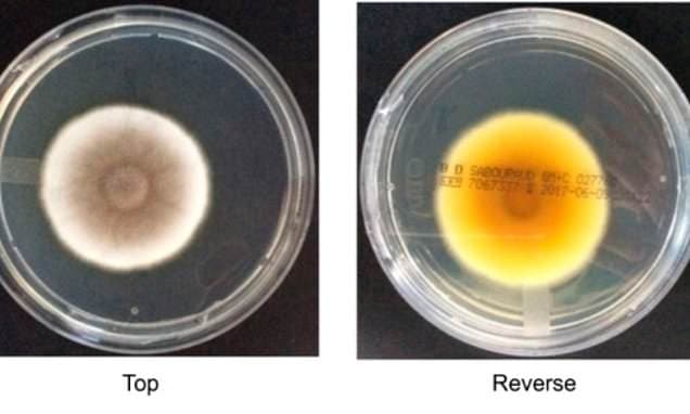 The fungus that could contaminate Mars: Scientists discover spore that can survive trip to the Red Planet - and NASA's ultra-sanitised cleanrooms aren't enough to stop it