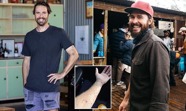 Winemaker's 'mystery rash' before devastating bowel cancer diagnosis sparks urgent warning over common chemical: 'I couldn't sleep for six days'