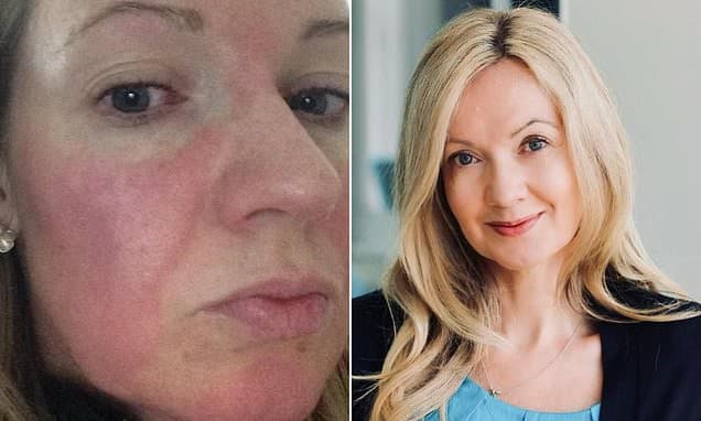 How I beat my allergies in four weeks - step by step, from the specific diet and amount of sleep needed to cleaning products