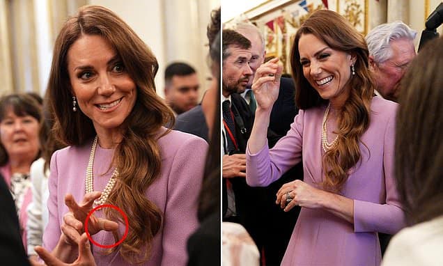 Kate Middleton sports a bandaged hand at late Queen's centenary celebrations... and it's not the first time she's had to wear plasters