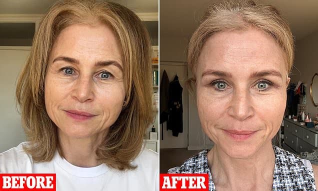 My droopy, hooded eyes were making me look grumpy and tired. But this subtle treatment that took less than an hour has totally rejuvenated my face - now people can't believe my age