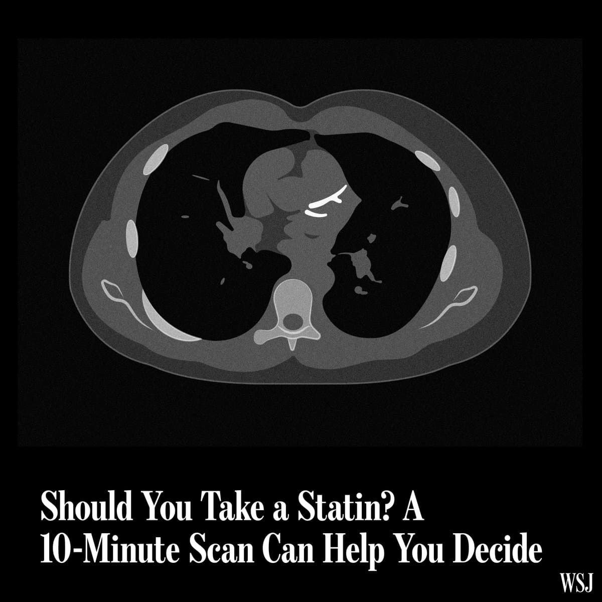 Measuring cholesterol levels has long been the main way doctors assess the risk of heart disease. Increasingly, people are opting, too, for a simple, relatively affordable test: a coronary artery calcium scan. Here’s more to know about the scans: 🔗 pic.