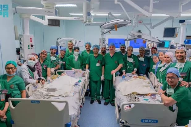Saudi Team Successfully Separates Filipino Conjoined Twins in Highly Complex Surgery