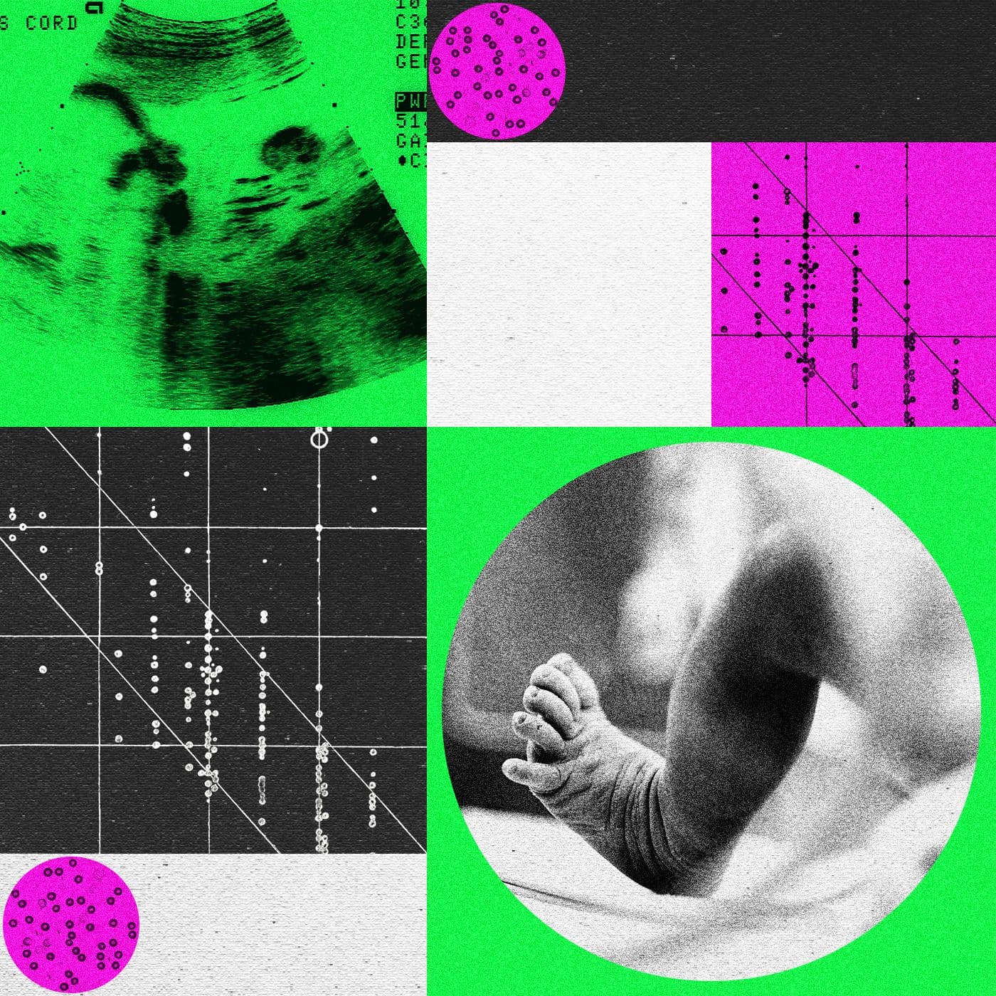 Designer Baby Companies Are in Turmoil